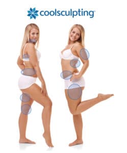 where-coolsculpting-and-cool-mini-treat-on-the-body