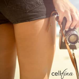 woman-in-shorts-with-a-camera
