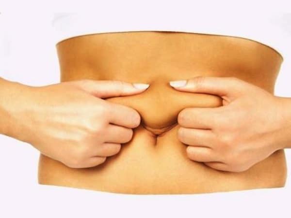 What to Expect After a Tummy Tuck