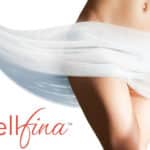 What Areas Can Be Treated With Cellfina?