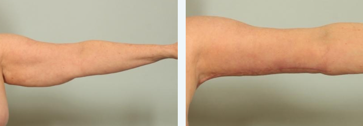 Screenshot-2023-04-29-001420 - El Paso Cosmetic Surgery