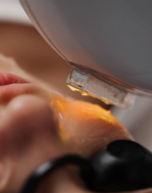 Laser Treatments Featured Image New - El Paso Cosmetic Surgery