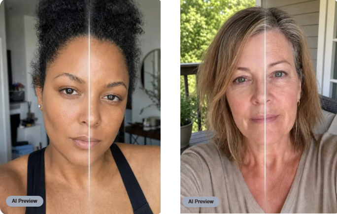 Preview Results Featured Image - El Paso Cosmetic Surgery